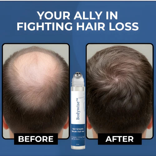 Hair Growth Serum